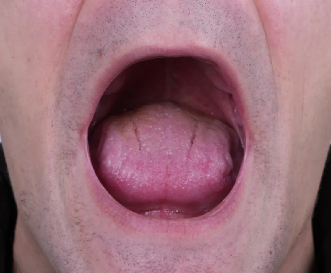 Serghii before treatment
